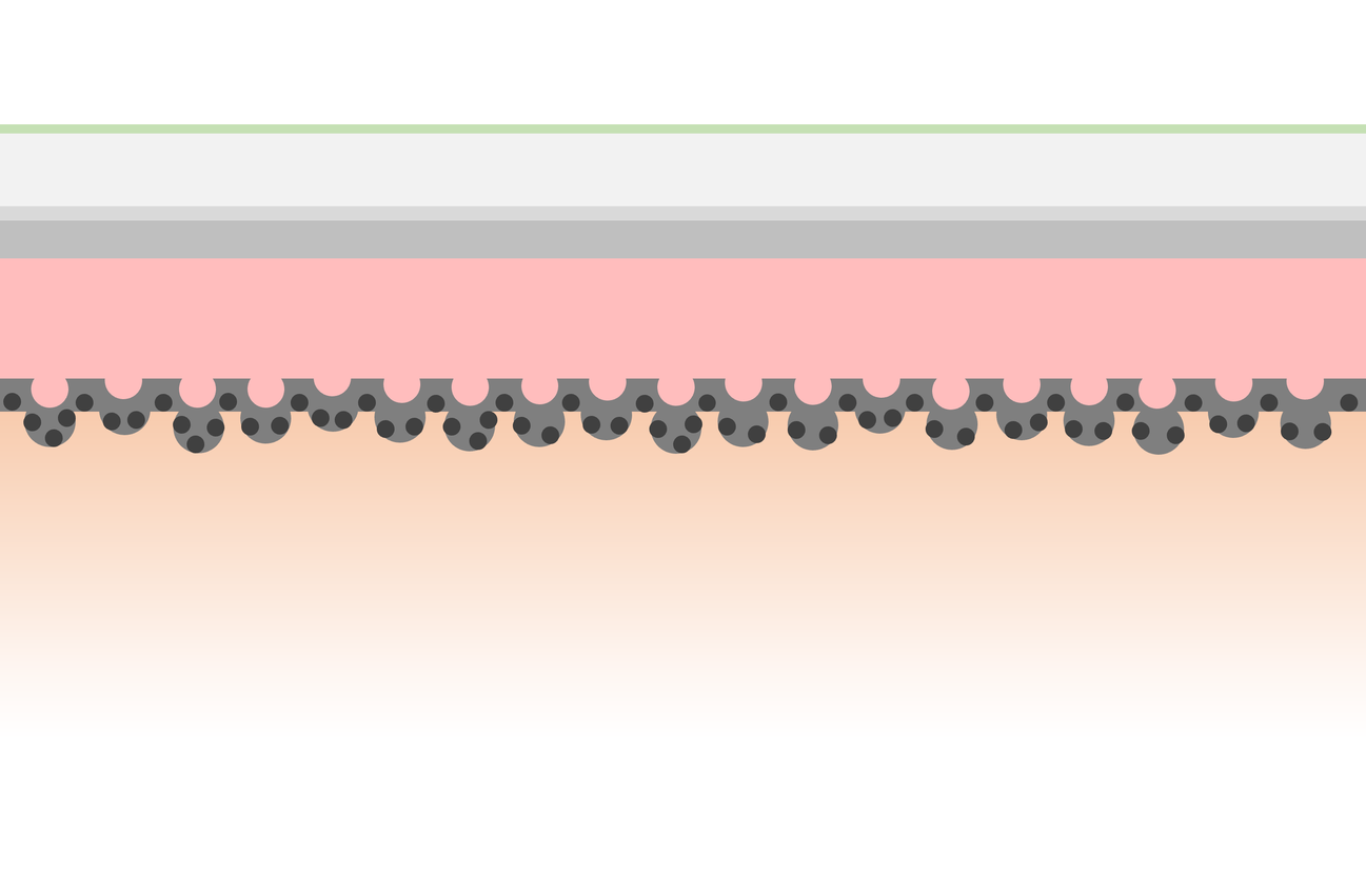 microporous_plating