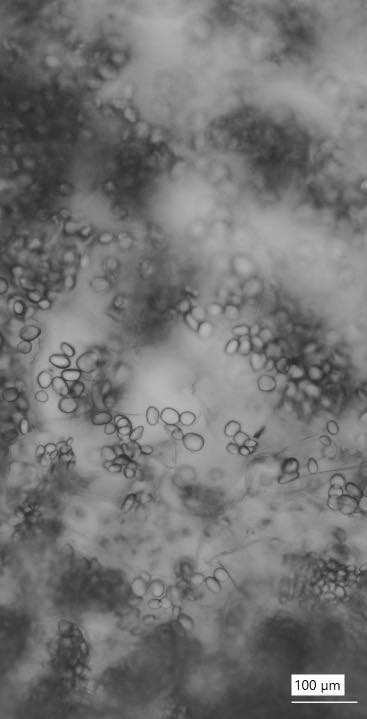 cell damage